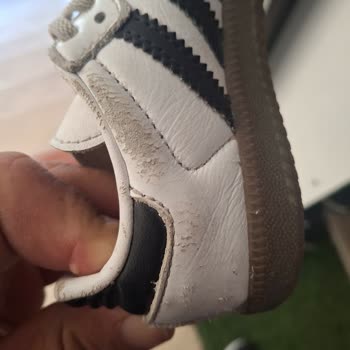 Adidas Ayakkabıda Kısa Sürede Ciddi Deformasyon Ve Yetersiz Garanti İncelemesi