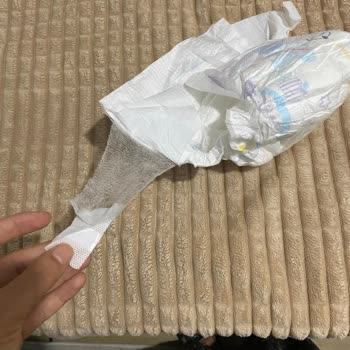 Molfix 4 Numara Bebek Bezlerinde Yapışkan Kısmı Kopma Sorunu Mağduriyet Yaratıyor