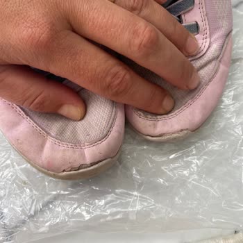 Dört Ayda Deforme Olan Ayakkabı Ve Reddedilen İade Talebi