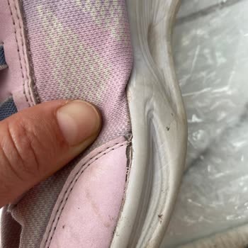 Dört Ayda Deforme Olan Ayakkabı Ve Reddedilen İade Talebi