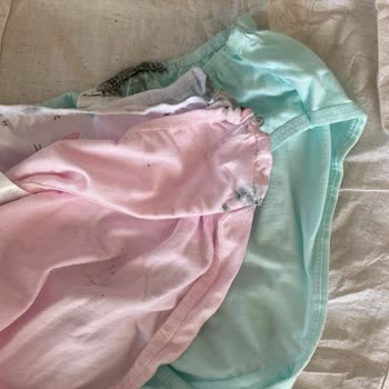 Eksik Ve Defolu Ürünler İçin İade Talebime Çözüm Sunulmuyor