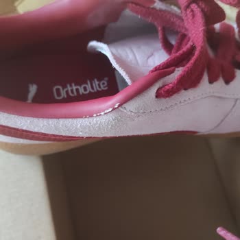 15 Günde Soyulan Ayakkabıya Ret Cevabı Ve Mağduriyet