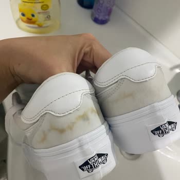 Kısa Sürede Deforme Olan Ayakkabı Ve Garanti Mağduriyeti