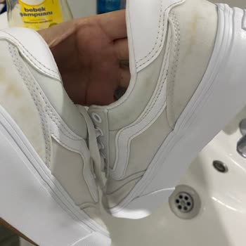 Kısa Sürede Deforme Olan Ayakkabı Ve Garanti Mağduriyeti