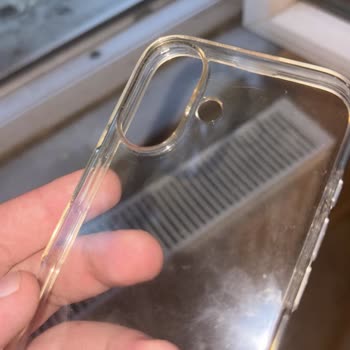 Spigen Kılıfın Hızlı Sararması Ve Yetersiz Müşteri Hizmeti