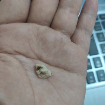 Çerezya Soslu Fıstık Paketinden Taş Gibi Sert Cisim Çıkması Endişe Yarattı