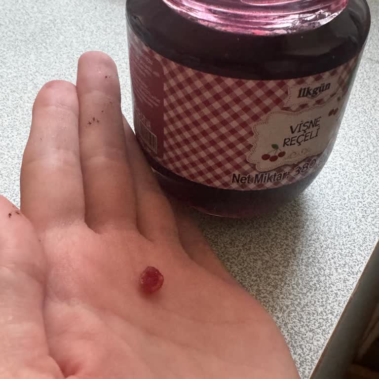 Vişne Reçelinden Çekirdek Çıkması Sonucu Yaşanan Sağlık Riski Ve Güven Kaybı