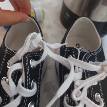 Converse Ayakkabı Ayağımı Yaraladı İade Talebim Reddedildi
