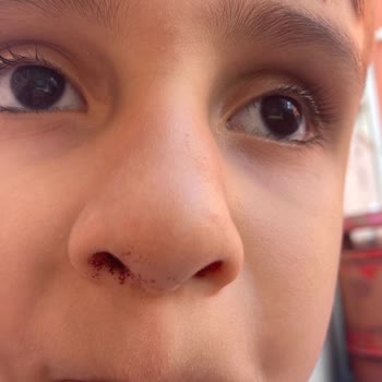 Okulda Yaşanan Darp Olayında İlgisizlik Ve Güvenlik Zafiyeti