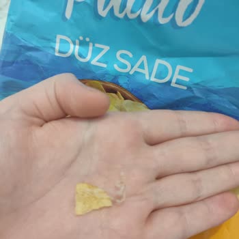 BİM'den Alınan Cips Paketinde Yabancı Cisim Şoku: Sağlık Ve Hijyen Endişesi