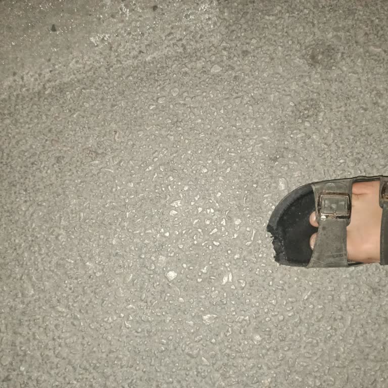 Yürüyen Merdivende Terlik Sıkışması Sonrası İlgisiz Ve Yetersiz Destek