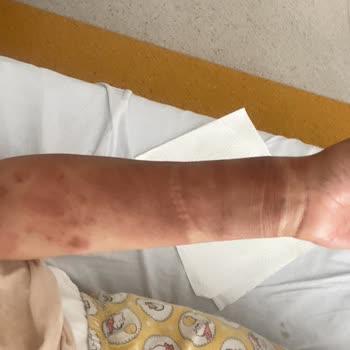 Schafer Düdüklü Tencere Patlaması: Güvenlik Riski Ve Mağduriyet