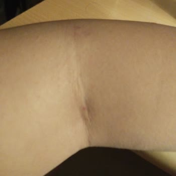 İskenderun Özel Gelişim Hastanesinde İlgisiz Personel Ve Yetersiz Hizmet Mağduriyeti