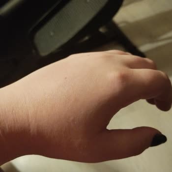 İskenderun Özel Gelişim Hastanesinde İlgisiz Personel Ve Yetersiz Hizmet Mağduriyeti