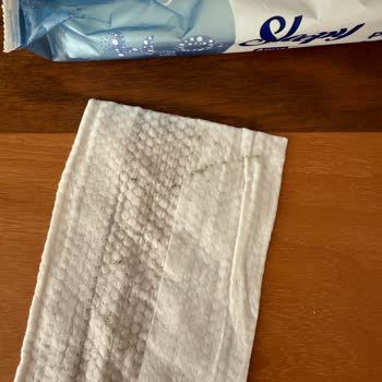 Sleepy Aqua Care Islak Mendillerde Küf Sorunu Ve Endişe