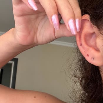 Çelik Diye Satılan Küpe Alerji Ve Yara Yaptı Mağaza Dönüş Yapmıyor