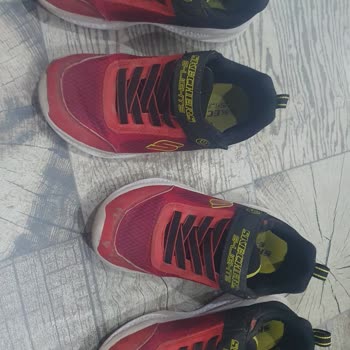 Yüksek Fiyatlı Skechers Ayakkabılarda Sürekli Yırtılma Ve Işık Arızası Hayal Kırıklığı