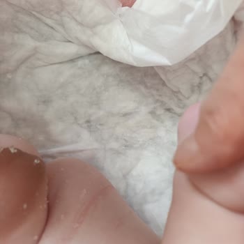 Molfix 3 Numara Bebek Bezinde Yırtık Ve Tanecik Sorunu, Bebeğimde Tahrişe Sebep Oldu