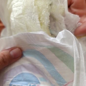 Molfix 3 Numara Bebek Bezinde Yırtık Ve Tanecik Sorunu, Bebeğimde Tahrişe Sebep Oldu