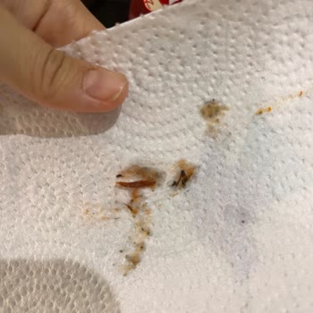 Ketçap Şişesinde Böcek Ölüsüyle Karşılaştım, Hijyen Sorunu Yaşadım