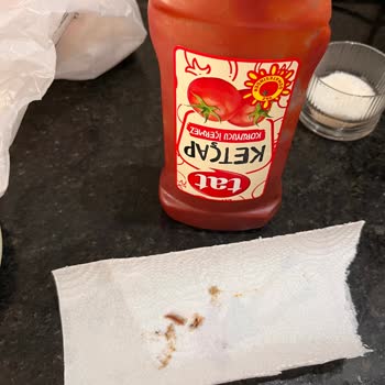 Ketçap Şişesinde Böcek Ölüsüyle Karşılaştım, Hijyen Sorunu Yaşadım
