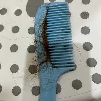 Son Kullanma Tarihi Geçmiş Saç Boyası Nedeniyle Yaşanan Mağduriyet Ve İlgisiz Müşteri Hizmeti