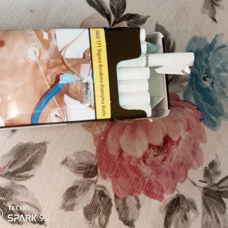 Chesterfield Sigarada Sürekli Hatalı Basım Mağduriyeti Yaşıyorum