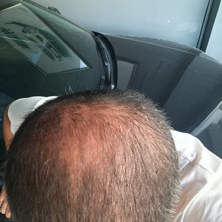 Ncr International Hospital Profesyonellik Sıfır, Güven Kesinlikle Yok