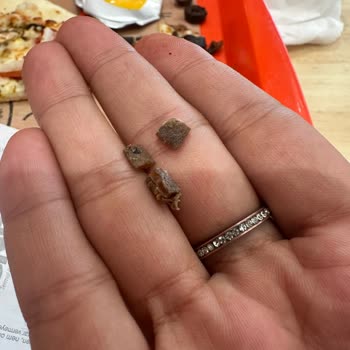 Zeytin Çekirdeği Nedeniyle Diş Telim Kırıldı, Mağduriyetimin Giderilmesini Talep Ediyorum