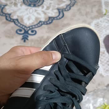 Adidas Ayakkabıda Garanti Reddi Sonrası Yaşanan Mağduriyet