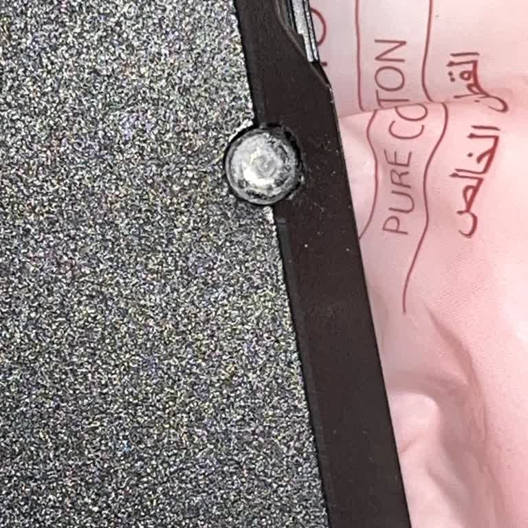 Servis Sonrası Vida Hasarı Ve Yetersiz Bilgilendirme Nedeniyle Mağduriyet