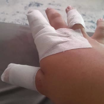 Bisikletin Orta Göbeği Aniden Ayrıldı Çocuğum Düştü