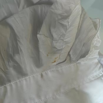 Kondisyonu Yüksek Olarak Satılan Gömlek Lekeli Geldi, İade Talebim Reddedildi