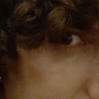 Trendyol Alerjik Reaksiyon Yapan Göz Kremi İçin İade Talebim Reddedildi