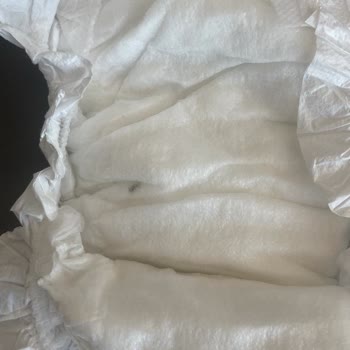 Bebek Bezinde Yabancı Cisim Şoku Ve Pişik Sorunu