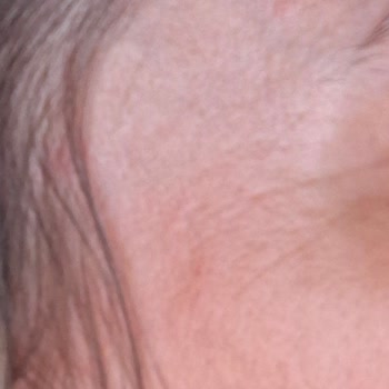 Clinic Allstar Yaptırdığım İşlemlerin Etkisini Görmedim