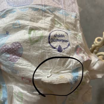 Molfix Bebek Bezinde Yabancı Maddeyle Karşılaşmak Güven Endişesi Yarattı