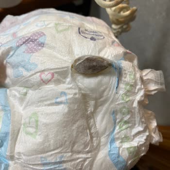 Molfix Bebek Bezinde Yabancı Maddeyle Karşılaşmak Güven Endişesi Yarattı