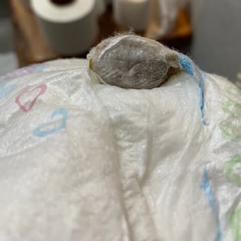 Molfix Bebek Bezinde Yabancı Maddeyle Karşılaşmak Güven Endişesi Yarattı