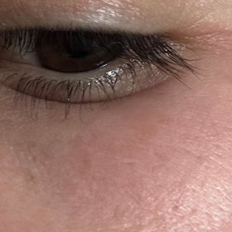 Yves Rocher Anti-AGE Global Göz Kremi Alerjik Reaksiyon Ve İade Talebi