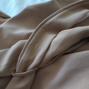 Kısa Sürede Deforme Olan Ferace İçin İade Talebim Reddedildi