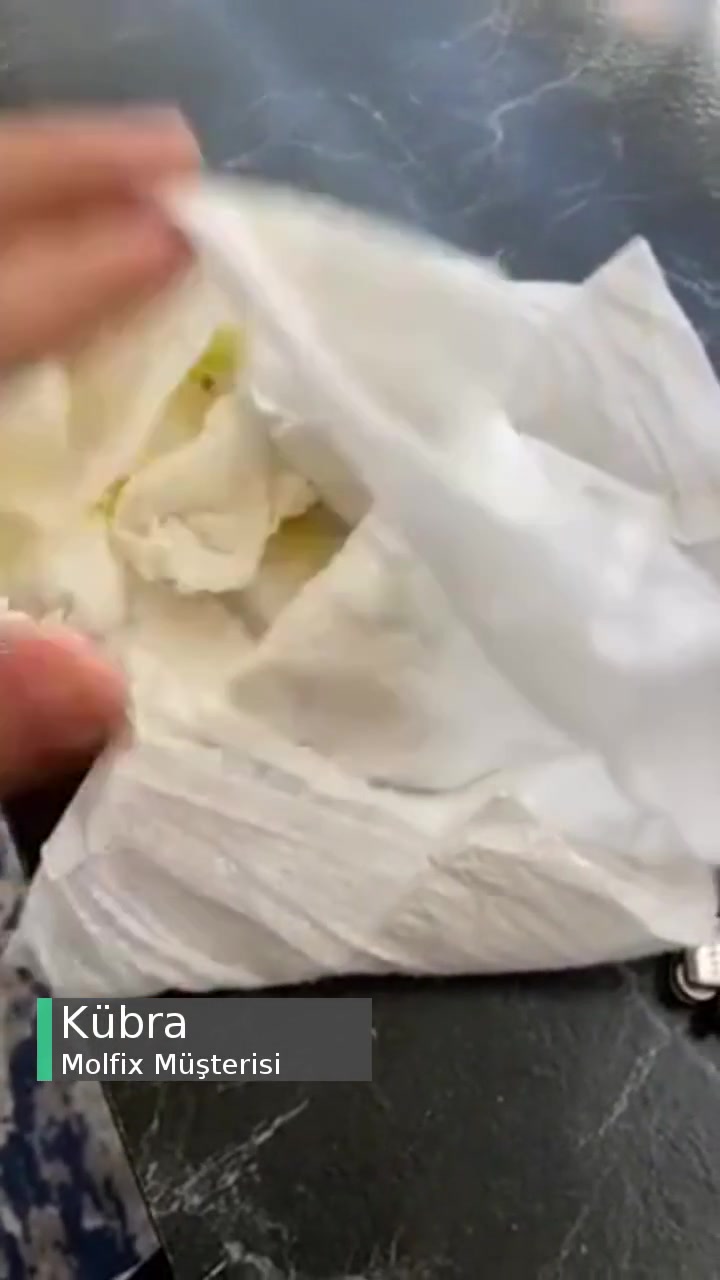 Molfix Bezde Sıkıntı Var! videonun kapak resmi