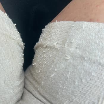 Kısa Sürede Deforme Olan Şort İçin İade Sorunu Ve Müşteri Hizmetleri Desteği Eksikliği