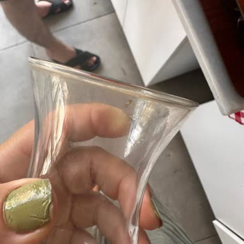 Sağlıksız Ortam, Kötü Yemekler Ve İlgisiz Hizmetle Kabusa Dönen Tatil