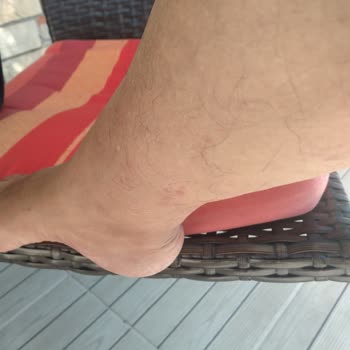 Satın Aldığım Yatak Takımından Kaynaklanan Tahta Kurusu Sorunu Ve Mağduriyetim