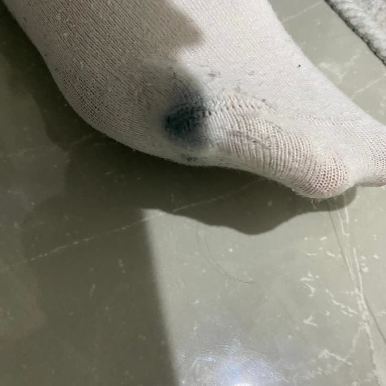 Bir Ayda Yırtılan Ayakkabıya Kullanıcı Hatası Denmesi Şaşırtıcı