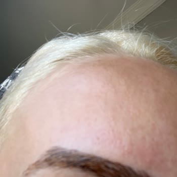 Microblading İşlemi Beklenenden Kısa Sürede Etkisini Kaybetti, Ücret İadesi Talep Ediyorum