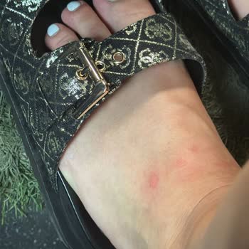 Aldığım Terlikler İlk Kullanımda Deforme Oldu Ve İade Talebim Reddedildi