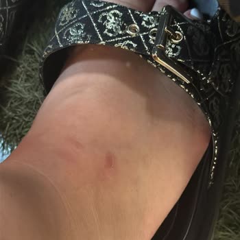 Aldığım Terlikler İlk Kullanımda Deforme Oldu Ve İade Talebim Reddedildi