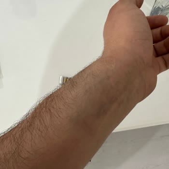 Garanti Kapsamındaki Saatte Kordon Sorunu Ve Haksız Ücret Talebi